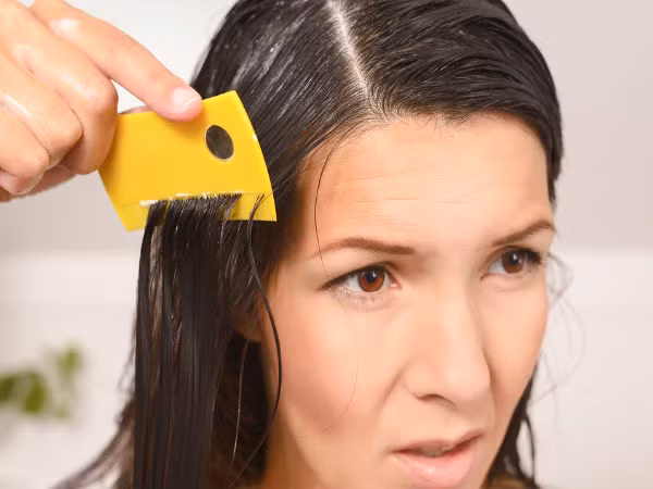 10. Trị chấy: Tinh dầu neem rất mạnh mẽ nếu bạn không may bị chấy trên đầu thì tất cả những gì bạn cần làm là sử dụng bôi tinh dầu lên da dầu và để qua đêm. Đến sáng, bạn có thể chải những con chấy chết khỏi tóc. Ảnh: Boldsky.