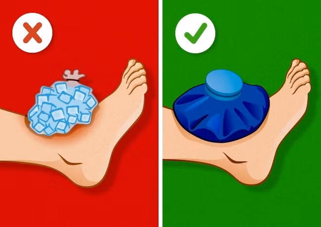 10. Trườm đá vào vết thâm tím: Đá thực sự là có thể làm giảm thâm tím nhưng bạn không nên đặt chúng trực tiếp lên da bởi bạn có thể bị bỏng lạnh. Cách làm đúng là đặt một miếng vải giữa đá và da. Chườm đá 20 phút, bỏ đá ra, đợi khoảng 20 phút rồi mới chườm tiếp 10 phút. Lặp lại như vậy vài lần. Ảnh: Brightside.