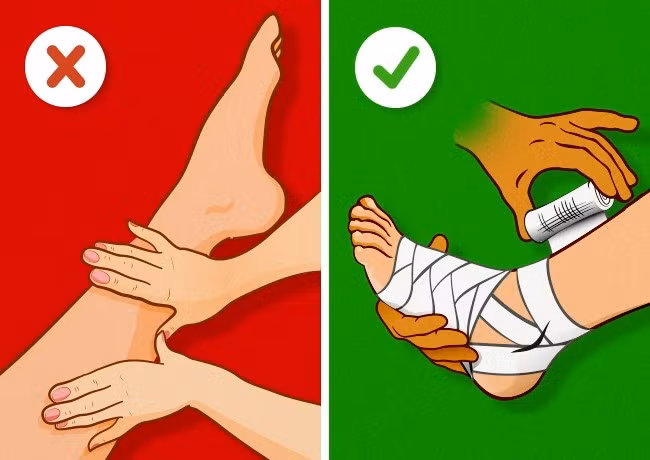 6. Tự “bẻ” lại khớp xương: Không nên tự “bẻ” lại khớp xương bởi việc này dễ khiến vết thương nặng thêm. Cách sơ cứu đúng là không động vào chỗ bị thương và lập tức đến bệnh viện gần nhất. Ảnh: Brightside.