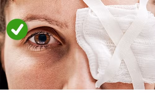 3. Dùng tay lấy dị vật trong mắt: Đây là một cách sơ cứu sai lầm và nguy hiểm bởi khi dùng tay banh mắt, bạn có thể sơ suất gây tổn thương nặng hơn. Do đó, khi mắt bị dính dị vật, hãy băng gạc lại và đến bác sĩ ngay. Nếu đó là một vết bỏng hóa học thì bạn cần ngay lập tức rửa mắt bằng nước. Ảnh: Brightside.