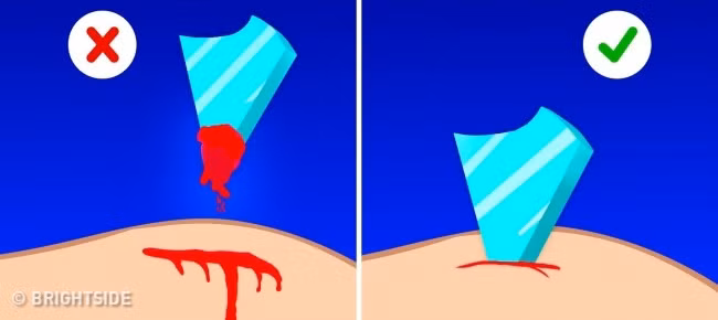 2. Kéo các mảnh vỡ khỏi vết thương trên da: Bạn có thể rút một mảnh vỡ từ ngón tay hoặc một mảnh vỡ bằng thủy tinh nhỏ từ bàn tay. Tuy nhiên, đừng bao giờ cố gắng kéo vật gì từ những vết thương nghiêm trọng. Hãy để nguyên chúng ở vị trí đó và đưa họ đến bệnh viện lập tức. Nếu bạn rút ra, có thể bệnh nhân sẽ bị chảy máu dẫn đến tử vong. Ảnh: Brightside.