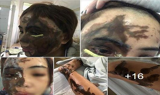 Thieu uy tat axit nguoi yeu: Phut cuong ghen, doi sau “boc lich”-Hinh-2