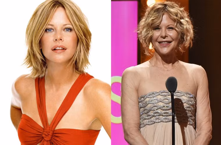 Phat hoang voi mat cung do bien dang cua sao Hollywood vi Botox-Hinh-12