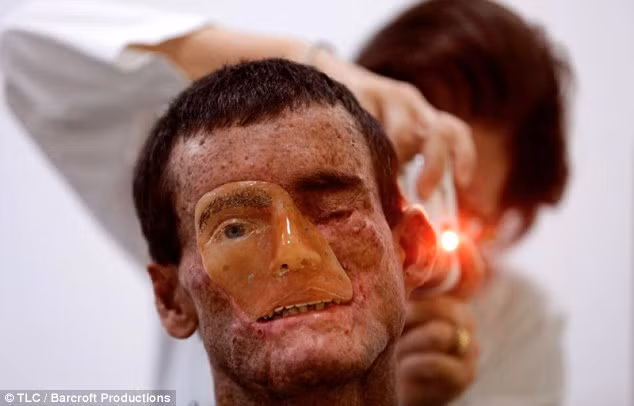 Làng Araras, thuộc Sao Paolo, Brazil được biết đến với cái tên "ngôi làng ma" do hầu hết người dân ở đây đều mắc bệnh XP (Xeroderma Pigmentosum), một hội chứng khô da sắc tố. Người mắc căn bệnh này không thể chống lại tia cực tím khi tiếp xúc với ánh nắng mặt trời. 