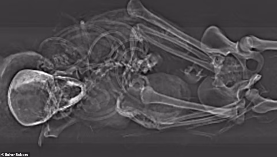 Hai tay của pharaoh Seqenenre Taa II không có vết thương nào và ở trong trạng thái nắm chặt. Từ đây, các chuyên gia suy đoán ông bị trói chặt 2 tay khi bị kẻ thù sát hại.