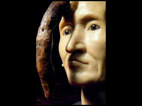 Theo một số ghi chép, bà Dimanche bất ngờ mọc một chiếc sừng giữa trán khi 76 tuổi. Chiếc sừng này có tốc độ phát triển nhanh trong 6 năm. Các chuyên gia đo được bà có chiếc sừng dài hơn 24,9 cm. Với chiếc sừng dài vươn qua mặt, che khuất tầm nhìn, bà Dimanche gặp một số khó khăn trong đời sống hàng ngày.