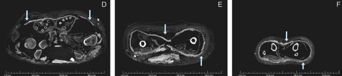 Do vậy, người phụ nữ được đặt trong quan tài khoảng 3.000 tuổi có khả năng không thuộc hoàng tộc Ai Cập.