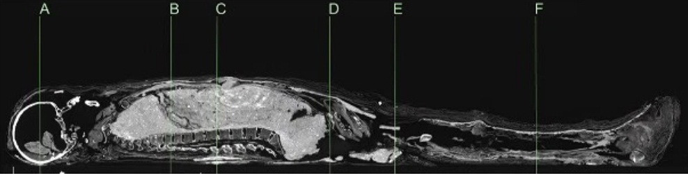 Cách đây hàng nghìn năm, các thi hài thuộc hoàng gia Ai Cập thường dùng vỏ nhựa quý giá để bọc lại trong quá trình ướp xác. Những tầng lớp thấp hơn trong xã hội dùng bùn thay thế nguyên liệu đắt giá trên.