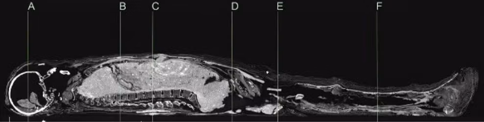 Cách đây hàng nghìn năm, các thi hài thuộc hoàng gia Ai Cập thường dùng vỏ nhựa quý giá để bọc lại trong quá trình ướp xác. Những tầng lớp thấp hơn trong xã hội dùng bùn thay thế nguyên liệu đắt giá trên.