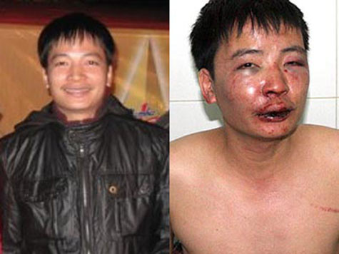  PV Báo Người lao động bị hành hung dã man Vào khoảng 19h15 ngày 6/1/2010, nhà báo Trần Thế Dũng, PV Báo Người lao động đã bị một nhóm cửu vạn buôn lậu hành hung dã man ở Lạng Sơn. Sau đó, thủ phạm hành hung nhà báo Dũng được xác định là Phan Bình An, sinh năm 1975, trú tại số 12, ngõ 13, đường Bắc Sơn, phường Hoàng Văn Thụ, TP Lạng Sơn, chỉ bị xử lý hành chính. Ngoài ra không làm rõ được đối tượng nào khác.