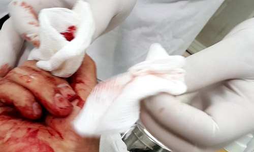 7. Nhà báo Đỗ Doãn Hoàng bị ba đối tượng lạ mặt dùng gậy đánh dã man Sáng 23/3 trên đường đi tác nghiệp, khi đến khu vực chung cư Kim Lũ (quận Hoàng Mai, Hà Nội) thì nhà báo Đỗ Doãn Hoàng (SN 1976, công tác tại báo Lao động) bị 3 thanh niên cầm gậy chặn đường và xông vào đánh tới tấp. Do vẫn đội mũ bảo hiểm nên phần đầu không bị ảnh hưởng nhiều, tuy nhiên, ngón tay trỏ của bàn tay phải đã bị đánh nát, nhiều vết trên người bị sưng to, trầy xước, bầm tím…