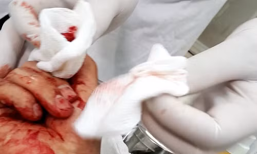 7. Nhà báo Đỗ Doãn Hoàng bị ba đối tượng lạ mặt dùng gậy đánh dã man Sáng 23/3 trên đường đi tác nghiệp, khi đến khu vực chung cư Kim Lũ (quận Hoàng Mai, Hà Nội) thì nhà báo Đỗ Doãn Hoàng (SN 1976, công tác tại báo Lao động) bị 3 thanh niên cầm gậy chặn đường và xông vào đánh tới tấp. Do vẫn đội mũ bảo hiểm nên phần đầu không bị ảnh hưởng nhiều, tuy nhiên, ngón tay trỏ của bàn tay phải đã bị đánh nát, nhiều vết trên người bị sưng to, trầy xước, bầm tím…