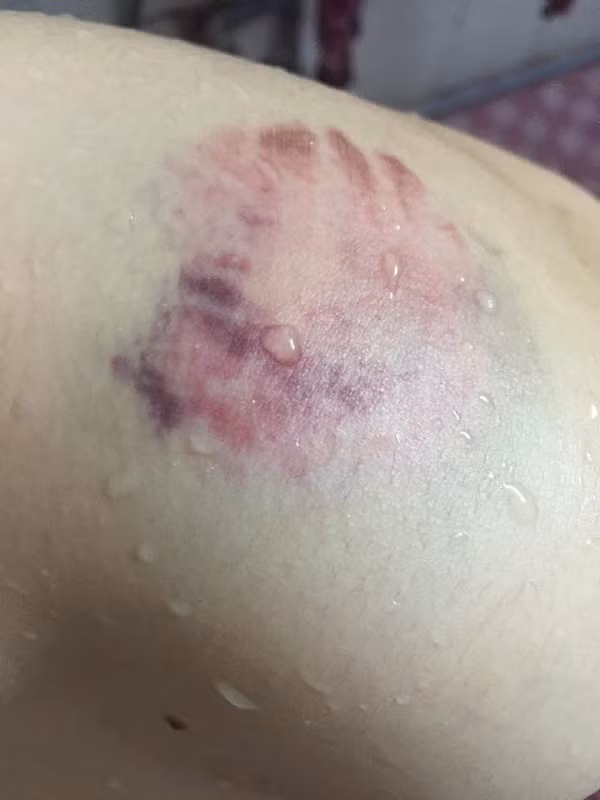 Cô cũng liên tục đăng video kể tội và "tố" hàng loạt những chuyện tồi tệ mà Vy đã làm với cô, từ đánh đập bầm tím cơ thể đến ép cô phải trả 3,5 triệu trong khi Vy có hẳn mấy trăm triệu trong tài khoản. Vì chưa có điều kiện trả nên sau đó Vy đã tự ý bắt con chó mà cả hai cùng đang nuôi đem bán với giá vài triệu đồng xem như gán nợ.