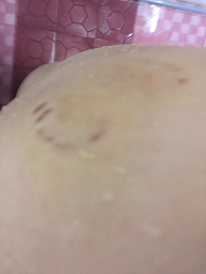 Hàng loạt những bức ảnh cơ thể bầm tím được My đăng tải với mục đích lột trần con người thực sự của Vy. Cô cũng chẳng nể nang mà khẳng định, hot girl phố đi bộ giống như "quỷ dữ".