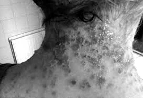 Nhap vien vi dung la cay thai doc thuoc Tay