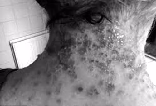 Nhap vien vi dung la cay thai doc thuoc Tay