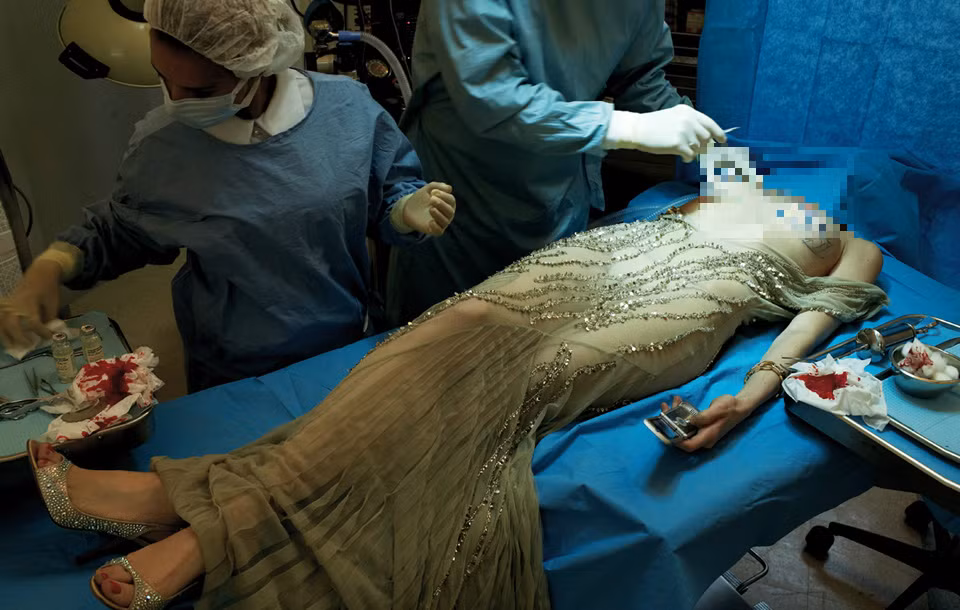 Không chỉ các thủ thuật cắt gọt từng chi tiết trên khuôn mặt, phẫu thuật nâng ngực cũng là phương pháp lôi kéo nhiều phái đẹp thực hiện.