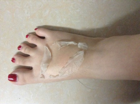  Tắm trắng bằng cách lột da. Không nên tắm trắng bằng cách lột da tại nhà vì có thể gây dị ứng da rất nghiêm trọng nếu không phù hợp với thành phần trong thuốc. 