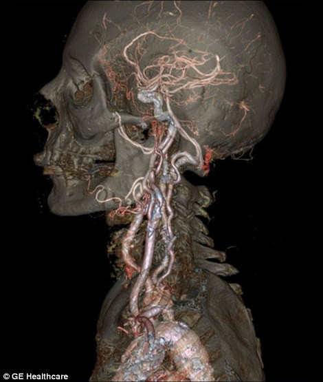  Cận cảnh các dây thần kinh từ hộp sọ truyền tín hiệu đến các cơ quan khác trong cơ thể con người. 