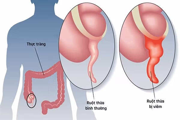 7 co quan noi tang du mat di ban van co the song khoe manh-Hinh-5