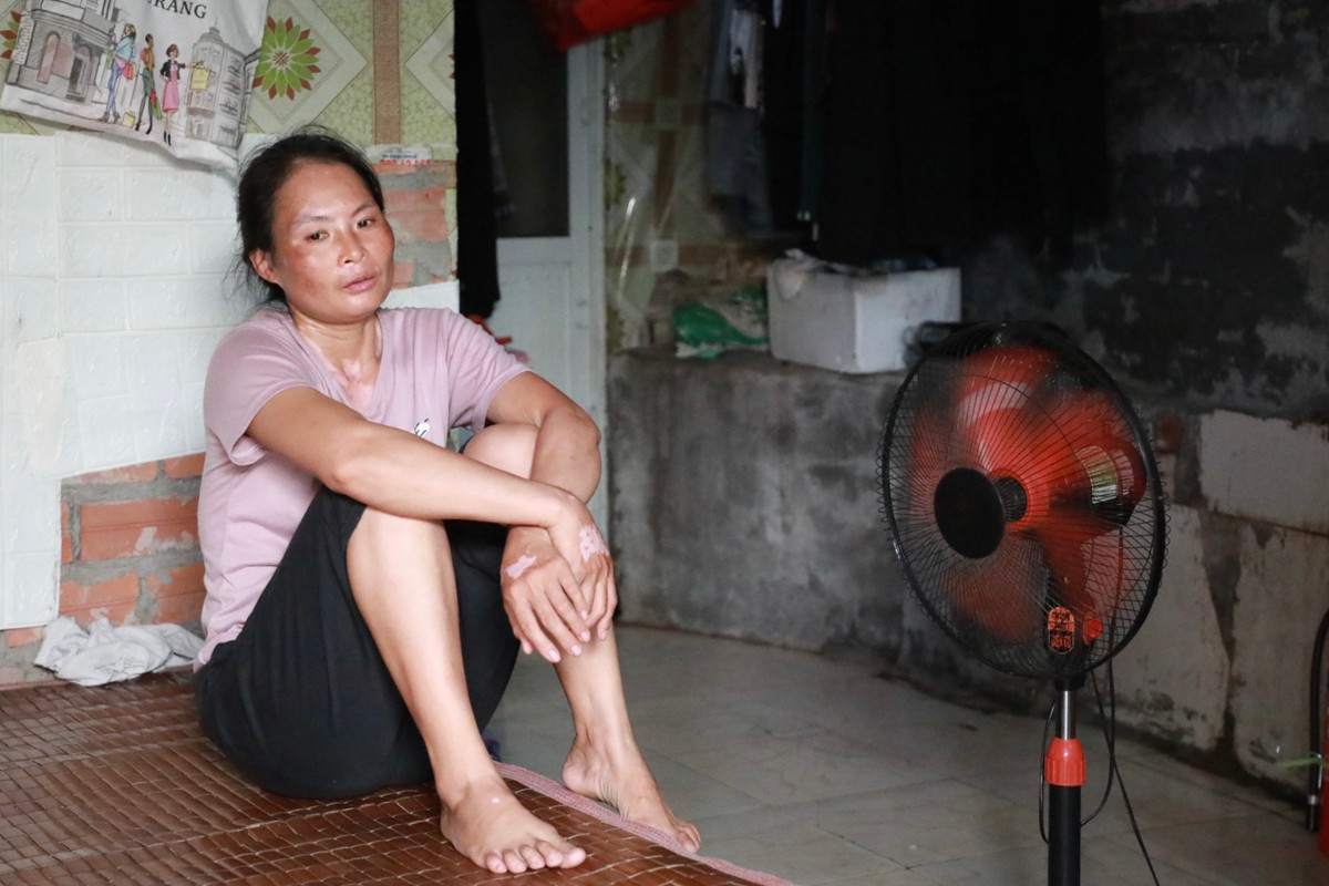 Gương mặt đen sạm vì nắng. Một giấc ngủ trọn vẹn giữa mùa nắng nóng là điều mà mọi người lao động đang sống tại các xóm trọ nghèo mong ước.