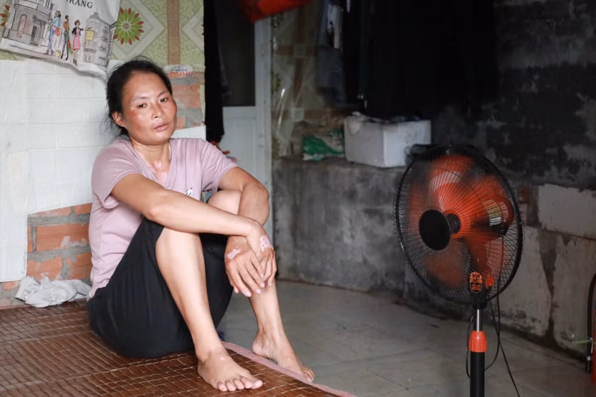 Gương mặt đen sạm vì nắng. Một giấc ngủ trọn vẹn giữa mùa nắng nóng là điều mà mọi người lao động đang sống tại các xóm trọ nghèo mong ước.