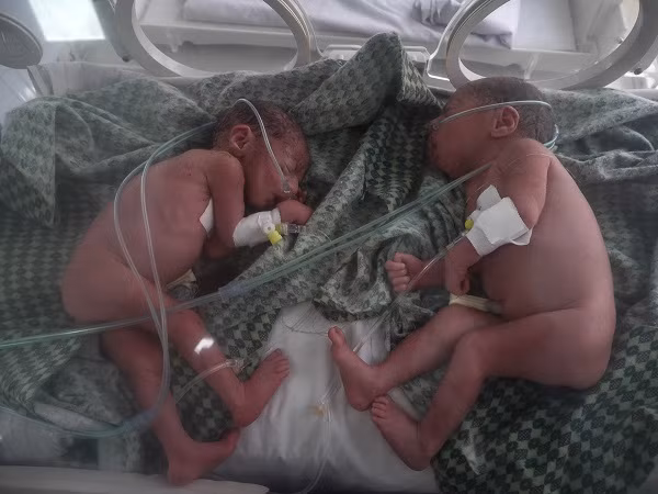 Hai em bé sơ sinh ngủ trong lồng kính tại phòng chăm sóc đặc biệt của bệnh viện Boost ở tỉnh Helmand. Được biết, hơn 12.700 đứa trẻ đã chào đời tại bệnh viện này năm 2015.