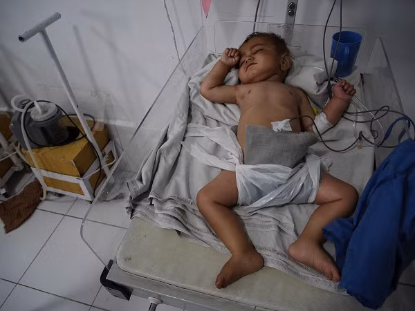 Bé “Abdullah” được tiếp nhận vào khoa chăm sóc đặc biệt của bệnh viện Boost ngày 18/5/2016 vì bị suy dinh dưỡng và tiêu chảy nặng. Bố mẹ của Abdullah cho biết, họ không thể đưa bé đến bệnh viện suốt hơn 1 tháng vì cuộc giao tranh liên tiếp giữa lực lượng chính phủ Afghanistan và phiến quân Taliban tại ngôi làng của họ.