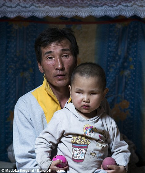 Ariunbold Baatarjav bên cạnh cô con gái mù lòa trong túp lều ở Nalaikh.