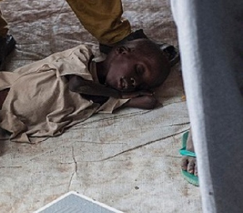 Hình ảnh một em bé da đen gầy trơ xương nằm dưới nền nhà khiến không ít người xót xa.