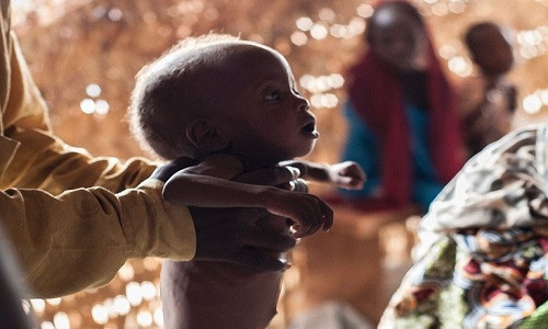 Rất nhiều trẻ suy dinh dưỡng ở Nigeria vì tình trạng thiếu lương thực trầm trọng.