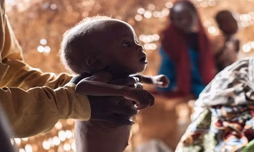 Rất nhiều trẻ suy dinh dưỡng ở Nigeria vì tình trạng thiếu lương thực trầm trọng.