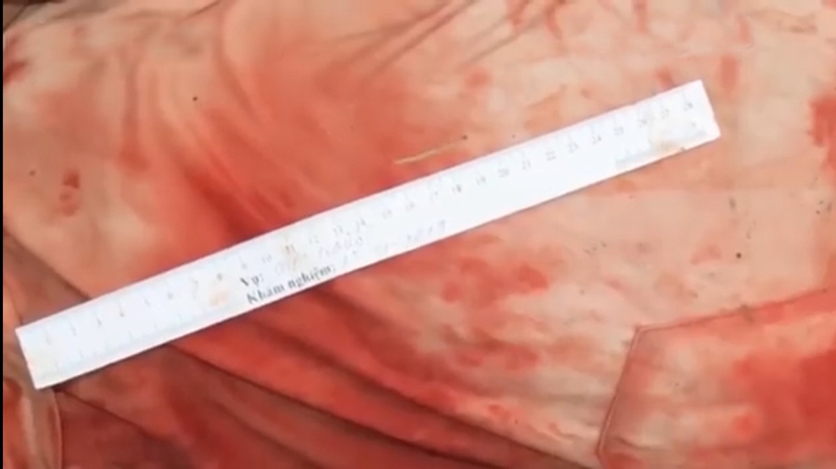 Cơ quan Công an xác định trên người nạn nhân có 1 vết đâm ở cạnh sườn và một vết cắt ở cổ. Nạn nhân tử vong do mất máu quá nhiều.