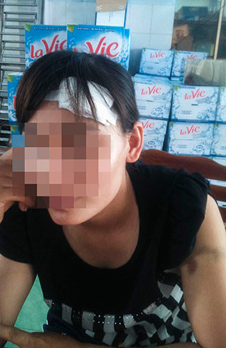 Chị Th. đã nhiều lần bị Bắc đánh đập, hành hung gây thương tích nặng.