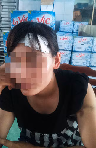 Chị Th. đã nhiều lần bị Bắc đánh đập, hành hung gây thương tích nặng.