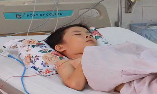 Bi ong vo ve dot toi tap, hai hoc sinh nguy kich