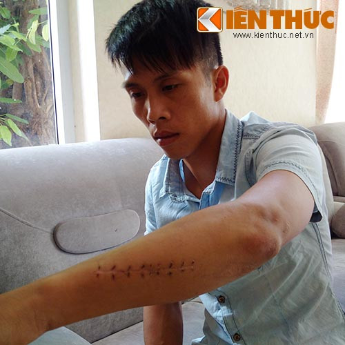 Giam doc cho con do truy sat cong nhan an chan hon nua ty-Hinh-4