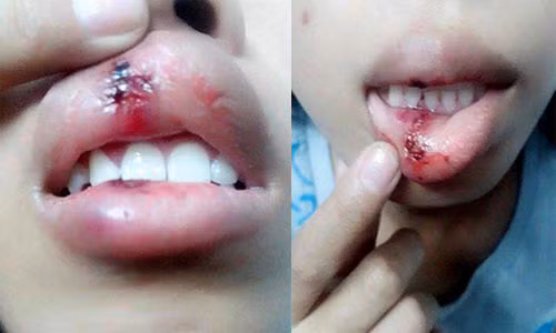 Thieu nu dap moi vi doi CSGT giai thich bi de doa tra thu?