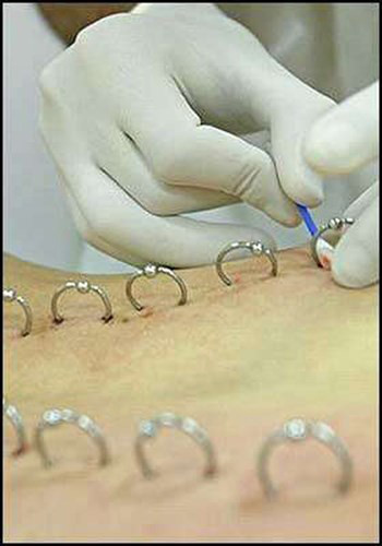 Liên tục những khu vùng kín của giới trẻ được chưng dụng nhằm thỏa mãn những thú vui kỳ quái. Hàng khuyên được xỏ chạy dài sau lưng, nhiều người thắc mắc, với vũ khí hiếm như thế này, chủ nhân của chúng sẽ có những kiểu ngủ khó khăn như thế nào?