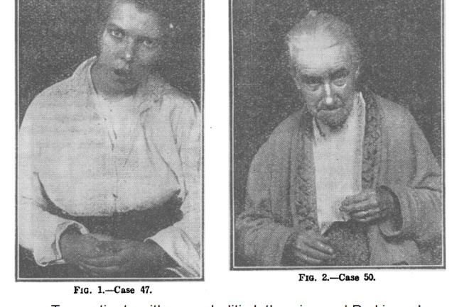 Theo các ghi chép, những người mắc căn bệnh bí ẩn này cảm thấy bản thân ở trạng thái đông cứng, không thể cử động cơ thể hoặc nói chuyện dù có ý thức.