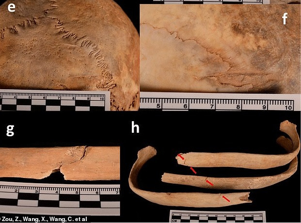 Từ đây, nhóm nghiên cứu nhận định người đàn ông này có thể bị một nhóm người tấn công và giết hại. Sau đó, thi thể nạn nhân bị ném vào trong hố sâu khoảng 4m trong mộ cổ để xóa dấu vết.