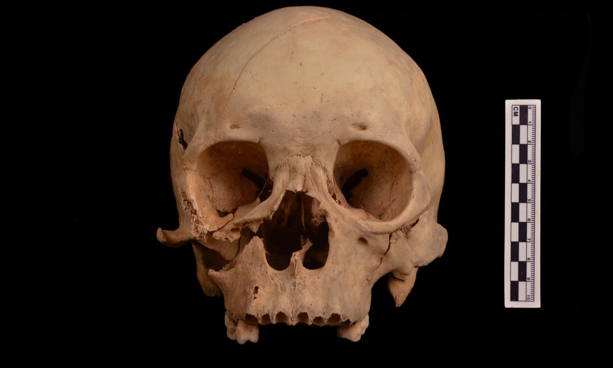 Kết quả kiểm tra bộ hài cốt cho thấy người đàn ông này sống vào thời nhà Đường. Nguyên nhân tử vong ban đầu được suy đoán có thể là do treo cổ hoặc bị tấn công nặng dẫn đến cái chết thương tâm.