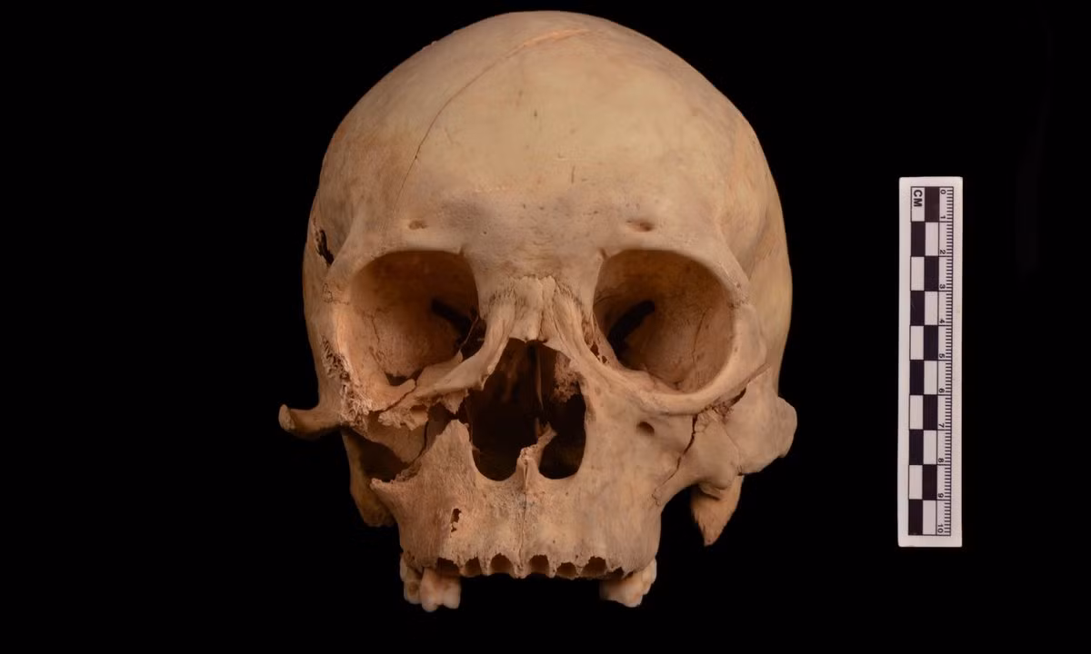 Kết quả kiểm tra bộ hài cốt cho thấy người đàn ông này sống vào thời nhà Đường. Nguyên nhân tử vong ban đầu được suy đoán có thể là do treo cổ hoặc bị tấn công nặng dẫn đến cái chết thương tâm.