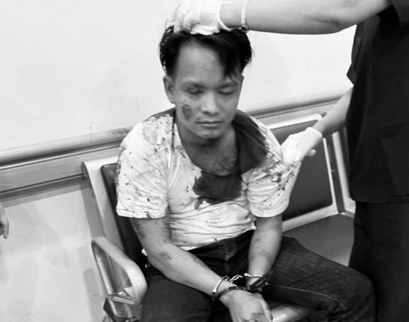 Đang lấy lời khai nghi phạm đâm tử vong cán bộ công an - Hình 2 Dang lay loi khai nghi pham dam tu vong can bo cong an-Hinh-2