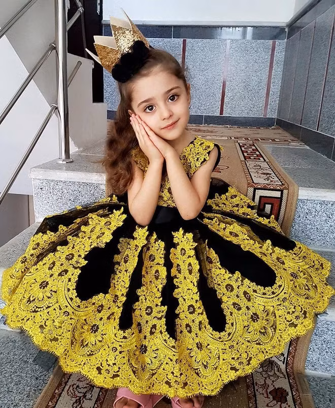 Những bức ảnh thơ ấu của Mahdis từng lan truyền khắp các nền tảng mạng xã hội, khiến ai cũng phải thốt lên: “Đẹp đến phi thực!”