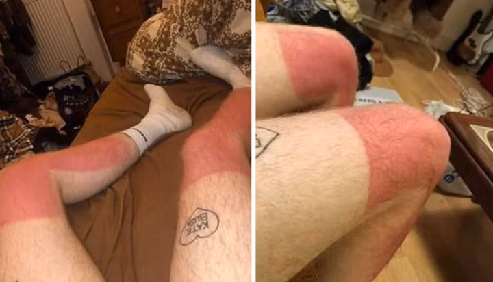 Loạt ảnh đã nhận được sự đồng cảm của nhiều người xem, đặc biệt vào những ngày hè nóng nực, nắng cháy da cháy thịt.