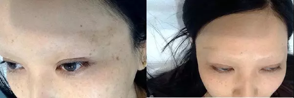 May mắn sẽ có được diện mạo ưng ý còn gặp vận xui lại chẳng biết giấu mặt đi đâu.