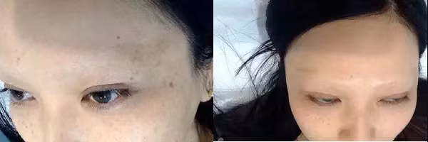 May mắn sẽ có được diện mạo ưng ý còn gặp vận xui lại chẳng biết giấu mặt đi đâu.