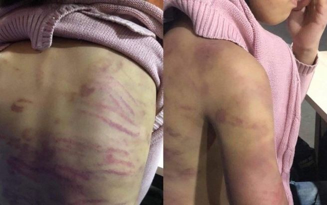 Ha Noi: Be gai 12 tuoi nghi bi me de bao hanh, nguoi tinh cua me ham hiep