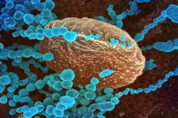 Hồi tháng 5, các nhà khoa học tại Trường ĐH Duke (Mỹ) tuyên bố họ đã phát hiện một loại virus corona gần giống như virus Haiti trên trẻ em ở một bệnh viện Malaysia.